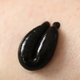 Illustration for article titled Best Leech Therapy Treatment In India